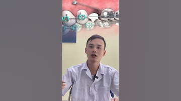 8 dấu hiệu mới niềng răng cần biết - Niềng răng #nhakhoa #rang