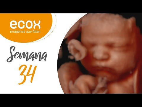 Ecografia 34 36 Semanas De Embarazo Ecox