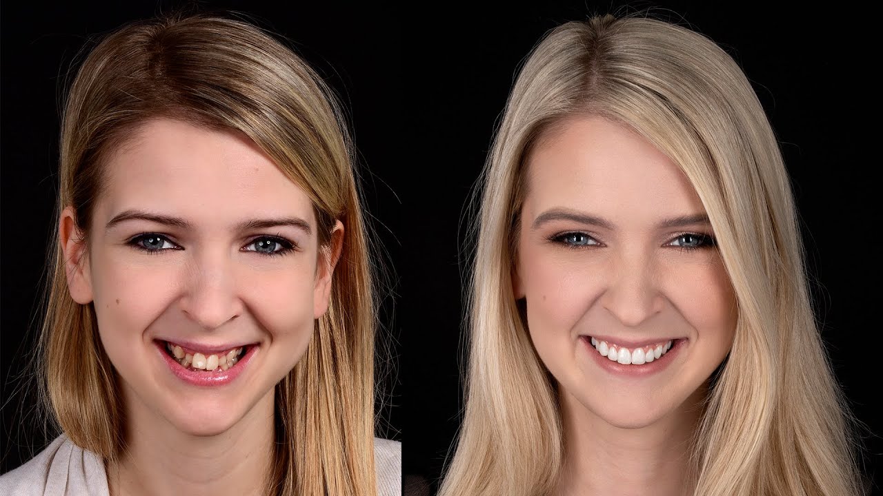 Metamorfoza uśmiechu Pani Eweliny !