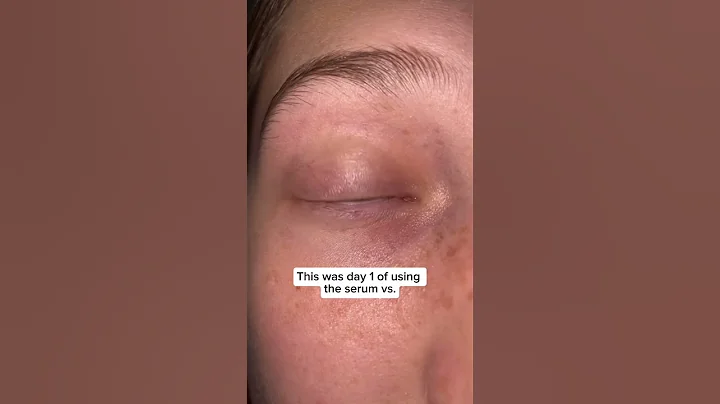 I ripped out all my eyelashes… #eyelashes