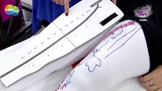Varis tedavisi nasıl yapılır?