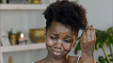 Why is my hair falling out after texturizer?