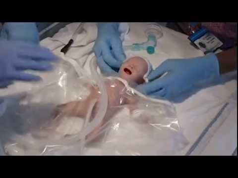 Video: Premature Baby: Evaluering Af Læge