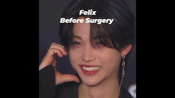 k-pop idols who got unnecessary surgery #felix @StrayKids
