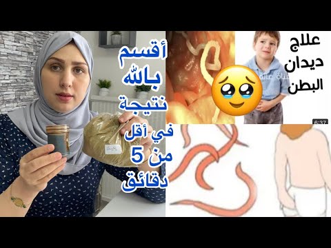 وصفة سحرية لعلاج ديدان البطن أقسم بالله نتيجة في أقل من 5 دقائق