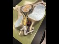 Cervical Spine Anatomy & Some Pathology
