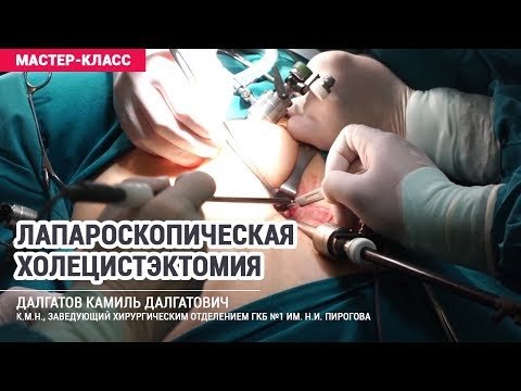 Лапароскопическая холецистэктомия