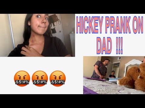 hickey-prank-on-my-dad