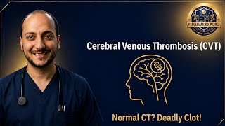 CVT Explained: The Brain Clot Hidden Behind a Normal CT Scan