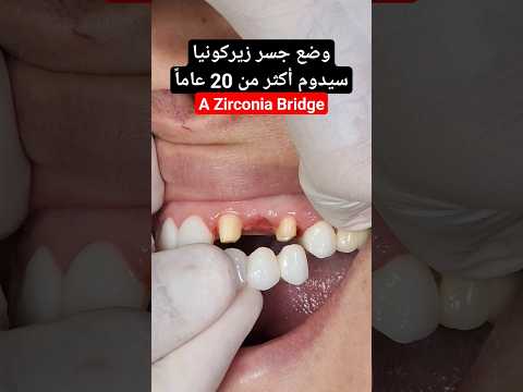 فيديو: كيفية اختيار أخصائي أمراض الفم: 8 خطوات (بالصور)