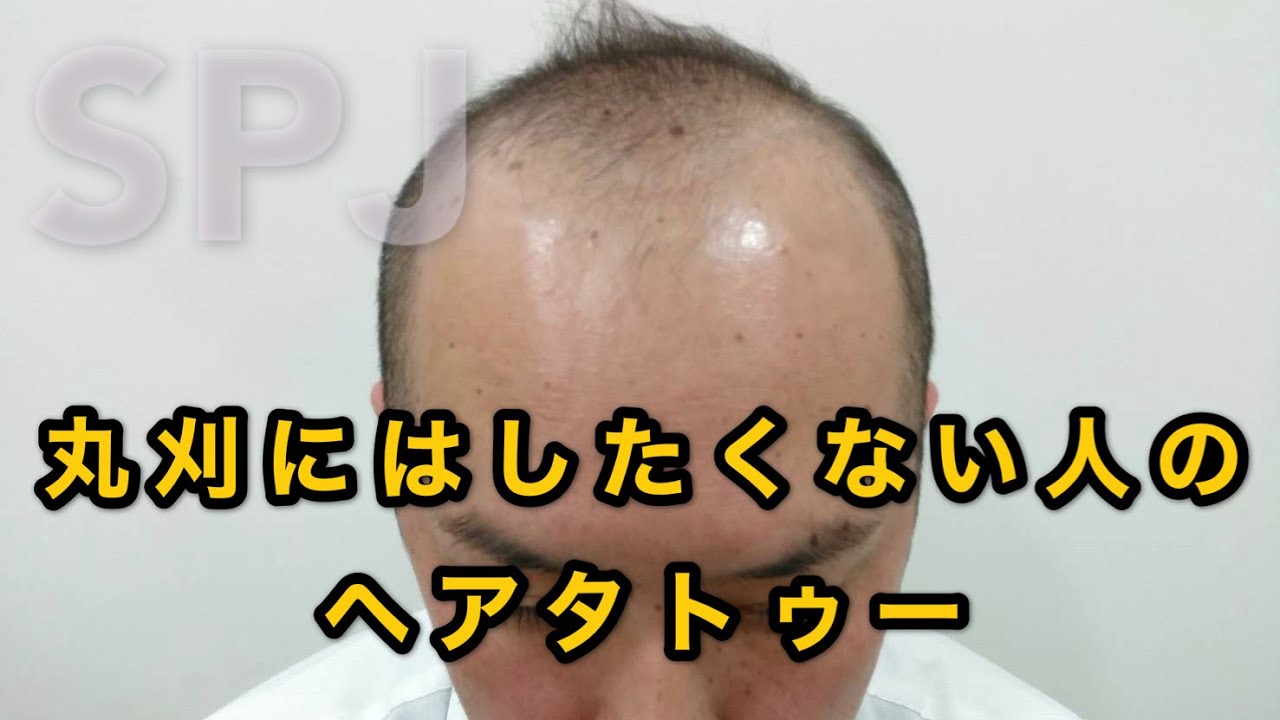 非丸刈りのヘアタトゥー ケーススタディ Youtube