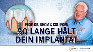 Wie lange hält ein Implantat? Pflegetipps und mehr