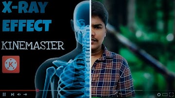 Create x-ray video in kine master || x-ray video create in 5minutes || #friendlyvfx