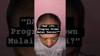 “179 hari konsisten… bagian crown mulai kelihatan berubah?”