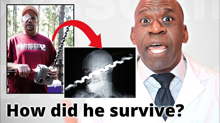 Surgeon Reacts To RON HUNT DRILL INJURY: How Did H...