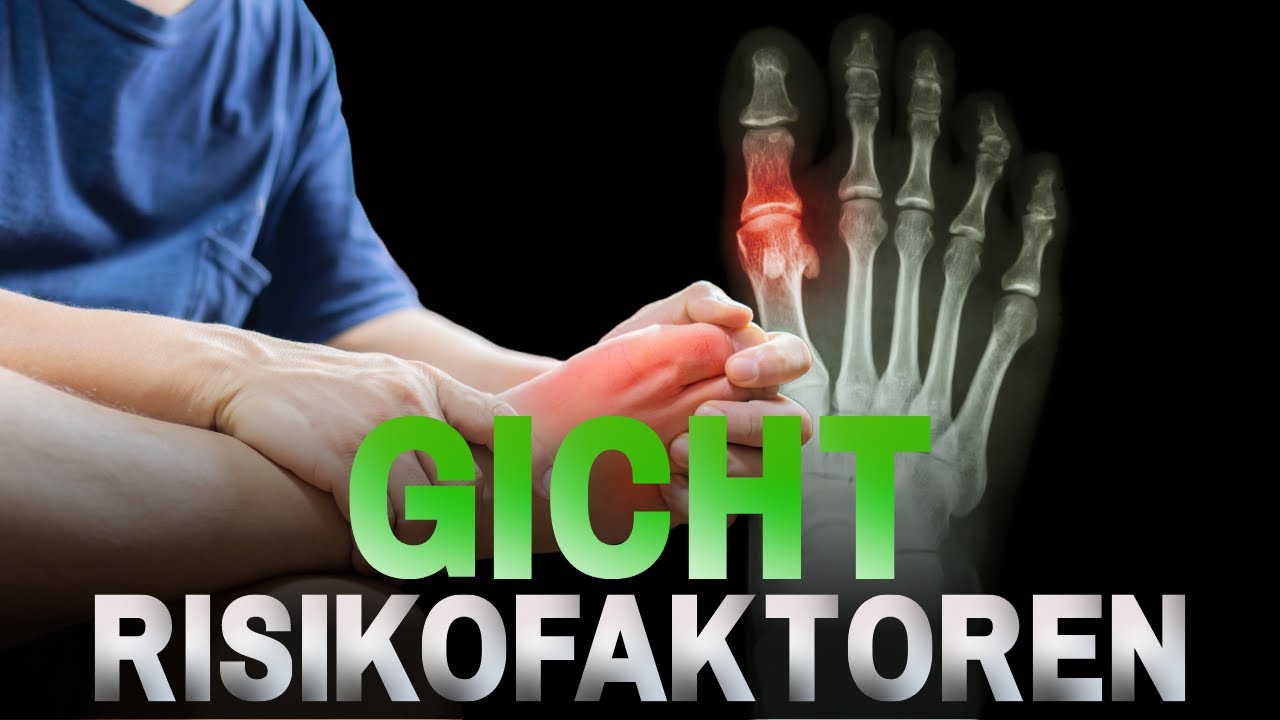 7 Symptome und Risikofaktoren von Gicht, die du kennen musst - YouTube