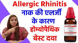 नाक की एलर्जी के लक्षण, ईलाज | Allergic Rhinitis ke Lakshan, Allergic Rhinitis homeopathic medicine