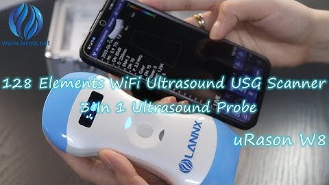 128 Elements WiFi Ultrasound USG Scanner 3 In 1 Ultrasound Probe uRason W8