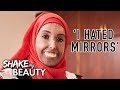 My Hardening Skin Doesn’t Stop Me Being Beautiful | SHAKE MY BEAUTY