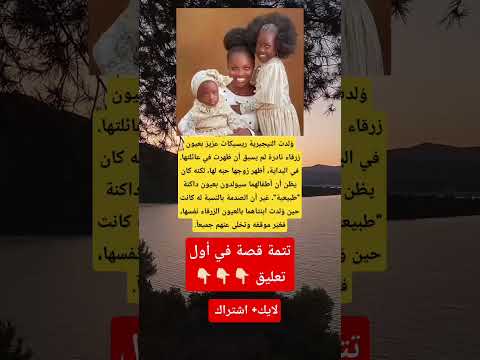 و لدت النيجيرية ريسيكات عزيز بعيون زرقاء نادرة لم يسبق أن ظهرت في عائلتها في البداية أظهر زوجها