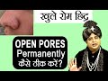 How to Get Rid of Open Pores Permanently, खुले रोम छिद्र कैसे ठीक करें || Sanyasi Ayurveda ||