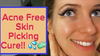 HOW TO GET ACNE FREE CLEAR SKIN STOP PICKING SKIN SOLUTION HOW TO FADE ACNE SCARS ?