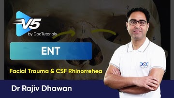 Facial Trauma & CSF Rhinorrhea | Dr. Rajiv Dhawan | ENT Made Easy | DocTutorials