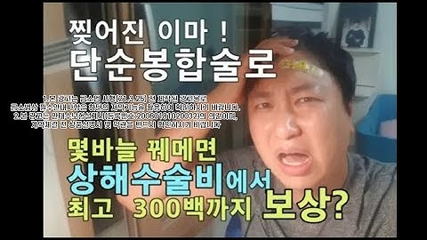 찢어진 이마 단순봉합술로 몇바늘 꿰메면 상해수술에서 최고 300백만원까지 보상된다고?