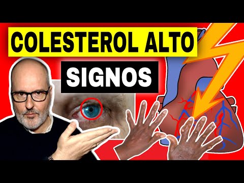 SIGNS (AND SYMPTOMS) OF HIGH CHOLESTEROL (CAUSES AND WHAT TO DO)