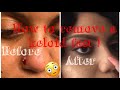 HOW TO GET RID OF YOUR NOSE PIERCING KELOID/BUMP FAST ! VIDEO INCLUDED