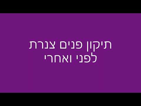 תיקון צנרת ביוב