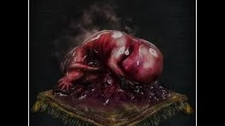 Bloodborne - how to farm red jelly (info in description) screenshot 5