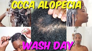 Ccca Alopecia Wash Day Hair Loss & Scalp Care