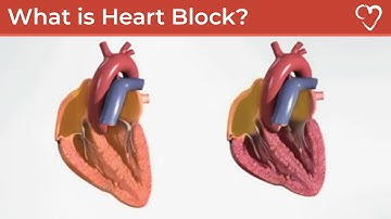 What is Heart Block?
