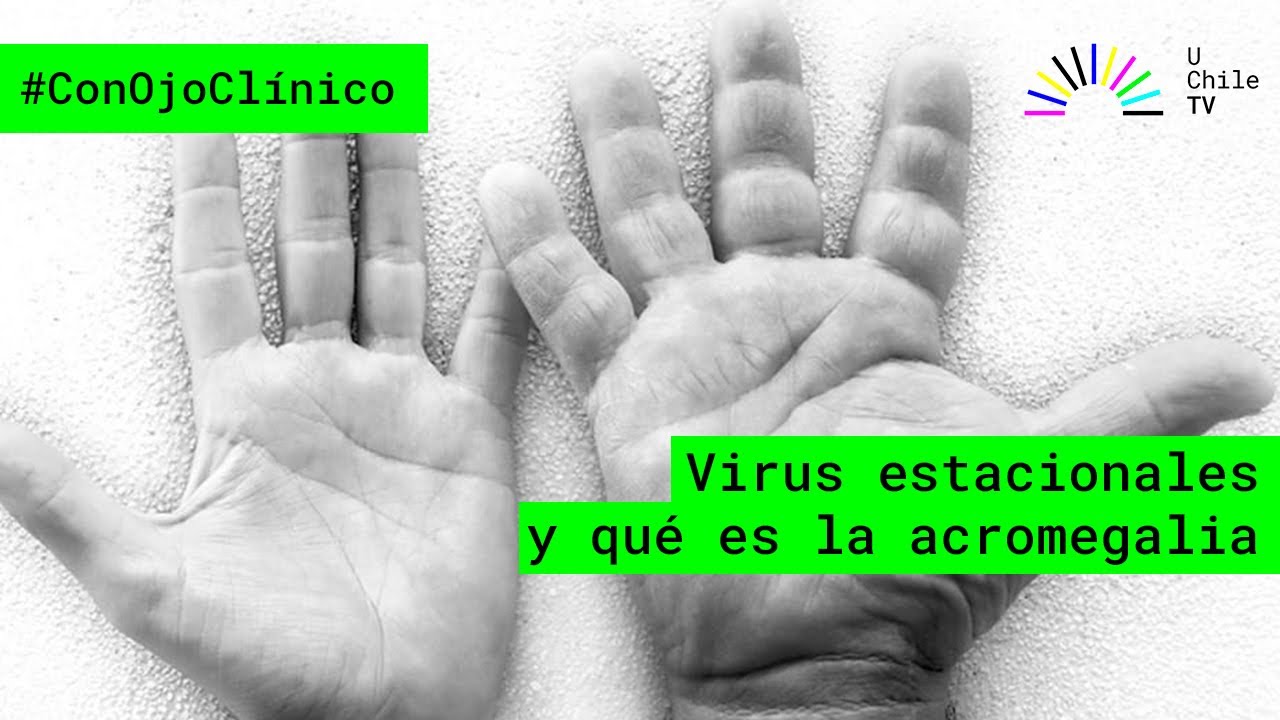 Con Ojo Clínico - CAP 39: Virus estacionales y qué es la acromegalia