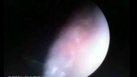 Chapter 14: 03 JAZZ: Foundational Articulation