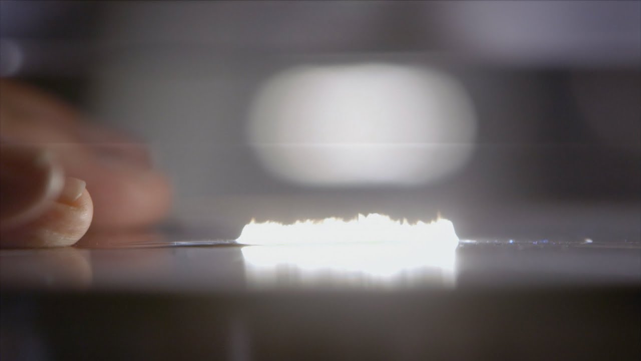 LASIK Surgery: How IBM's Dr. James Wynne Discovered It