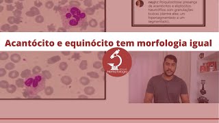 Acantócito E Equinócito Tem Morfologia Igual