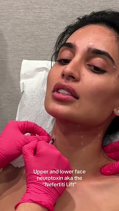 Beautiful Facial Balancing Treatments & Filler Results! #facialcontouring #filler