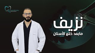 نزيف ما بعد خلع الأسنان | دكتور خالد بنداري