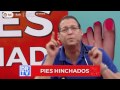 Pies y tobillos hinchados - causas y tratamientos