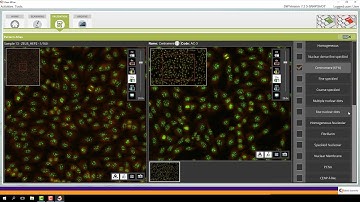 ZEUS dIFine® ANA HEp-2 Pattern Atlas is here to help