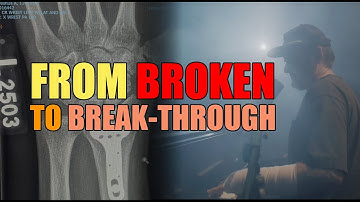 I Wrote This Song With Broken Wrists in 12 Minutes (Then Made a Music Video)