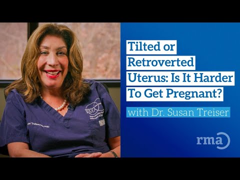 Wideo: Jak odwrócić retrowersję macicy?