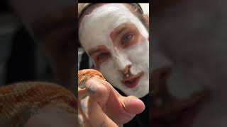 How to survive Hognose Snake bite! When #selfcare goes wrong lol my girlfriend made me do it
