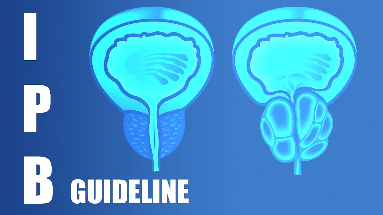 Curare l'Ipertrofia Prostatica Benigna (IPB) - Linee Guida 2025