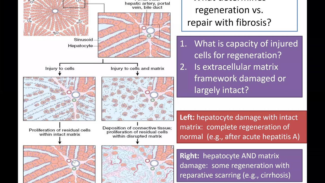 MoD - Session 4 - Lecture 1 - Regeneration and Fibrous Repair