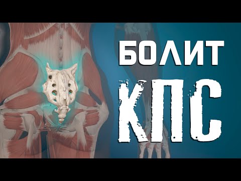 Как разблокировать крестцово-подвздошный сустав? Боль в КПС?