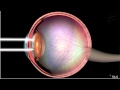 Structure and Working of Human Eye