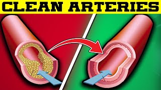 Supercharge Your Heart: 8 Potent Foods to Unclog Arteries and Shield Against Heart Attacks